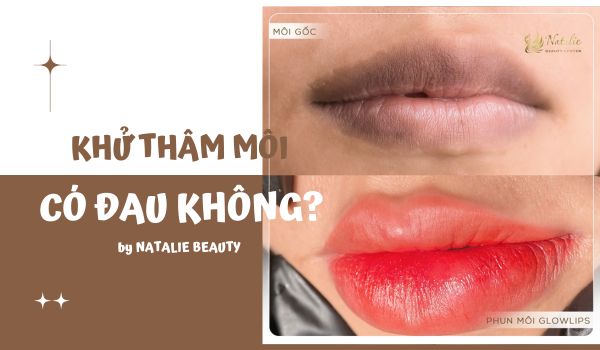 khử thâm môi có đau không