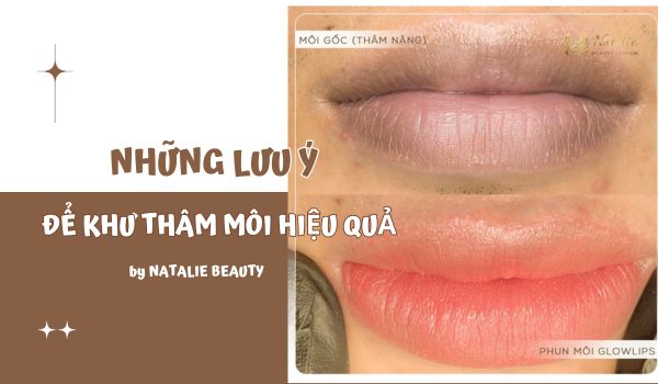 lưu ý để khử thâm hiệu quả