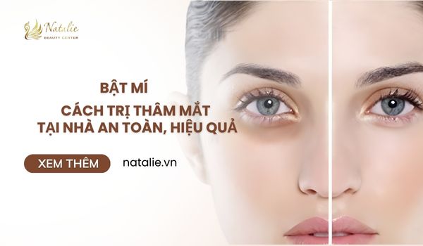 cách trị thâm mắt tại nhà