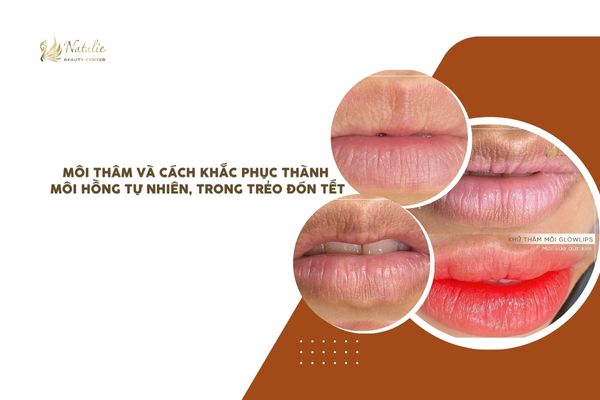 khử thâm thành hồng