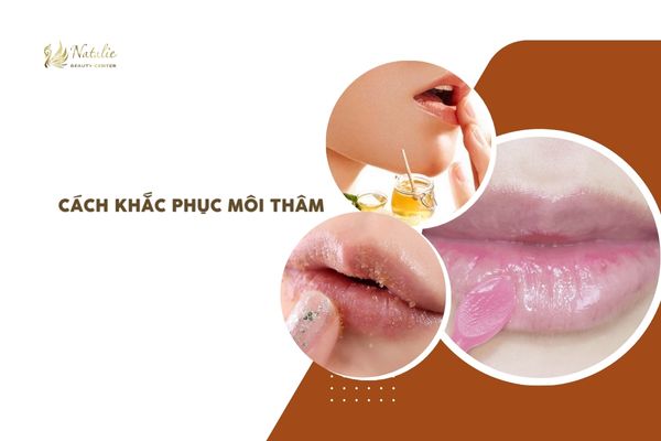 dưỡng môi tự nhiên