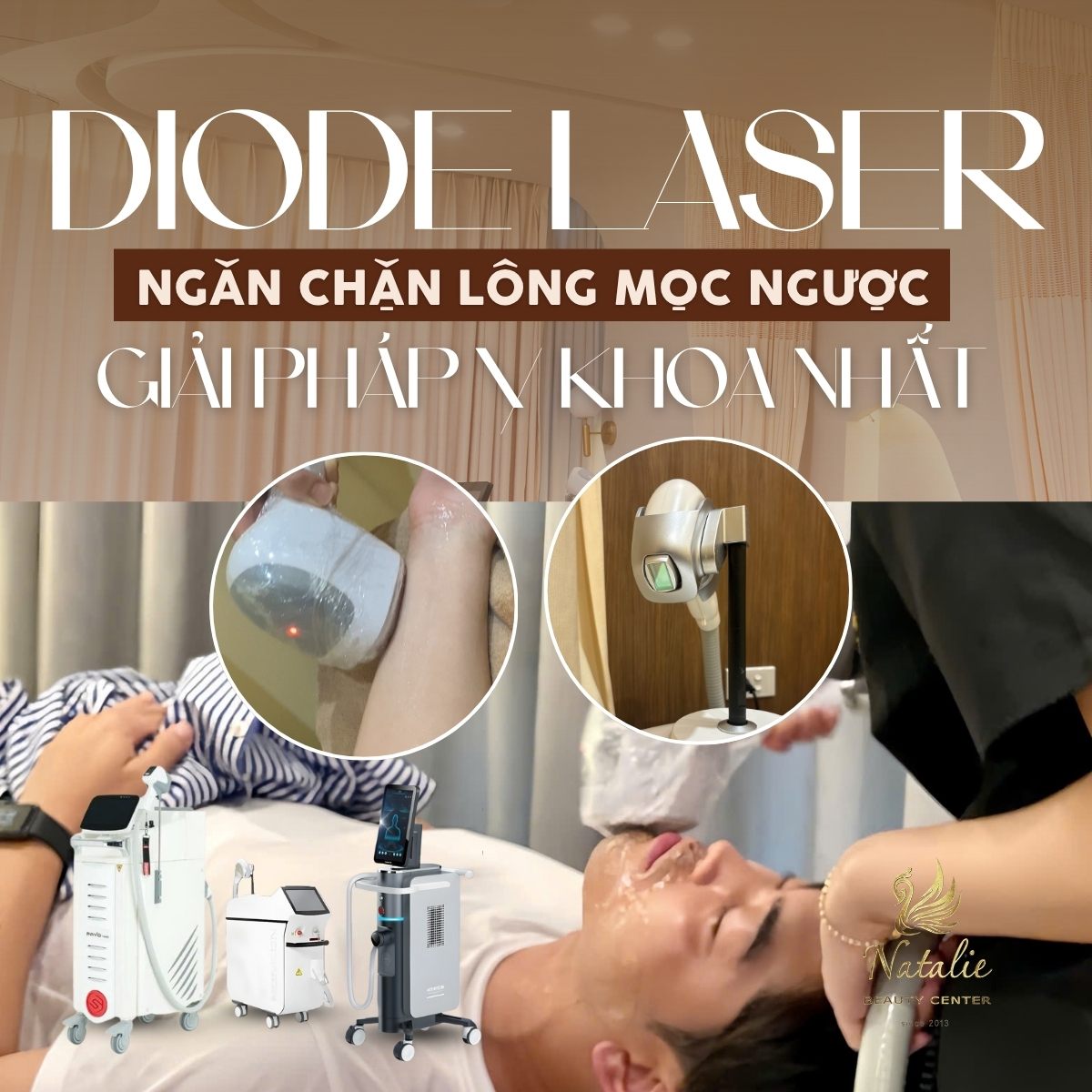 ngăn chặn lông mọc ngược