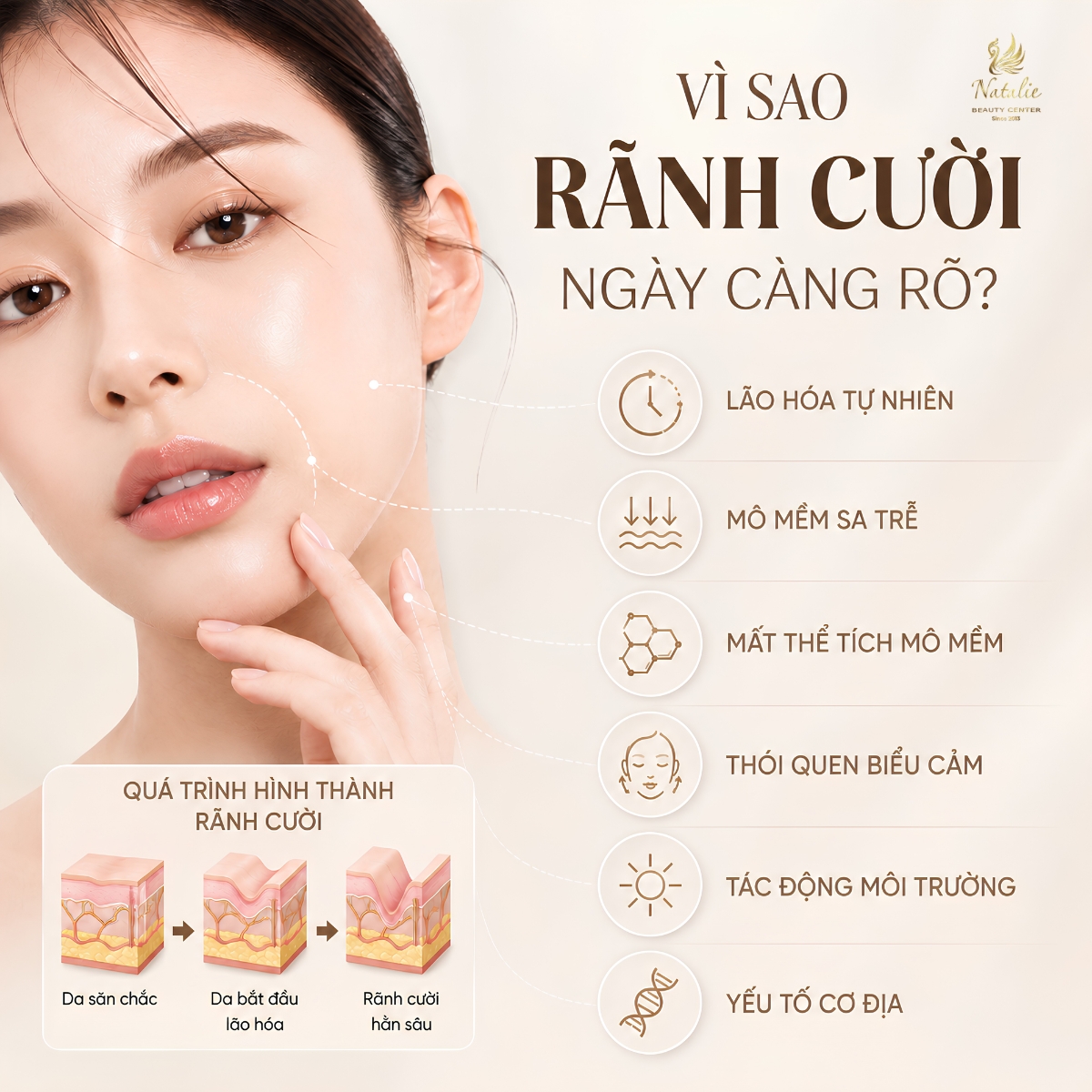 rãnh cười ngày càng rõ