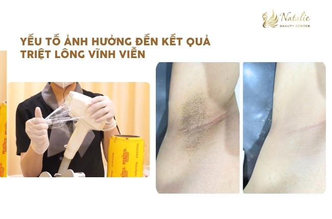 yếu tố ảnh hưởng kết quả