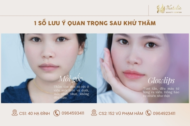 lưu ý sau khử