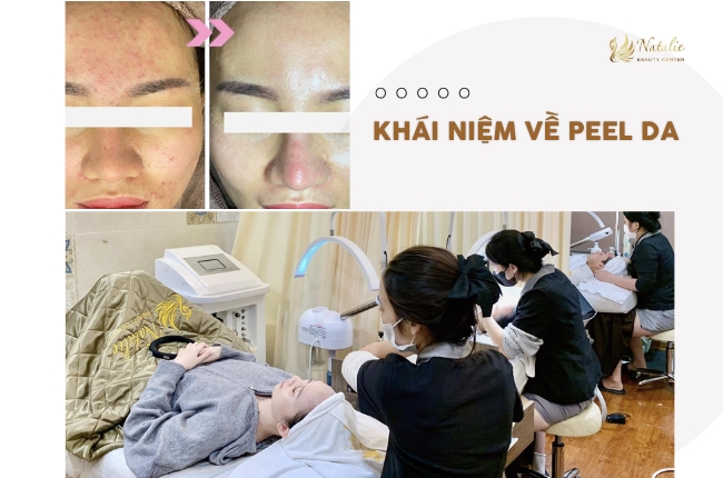khái niệm peel da