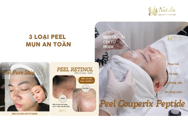 3 loại peel an toàn
