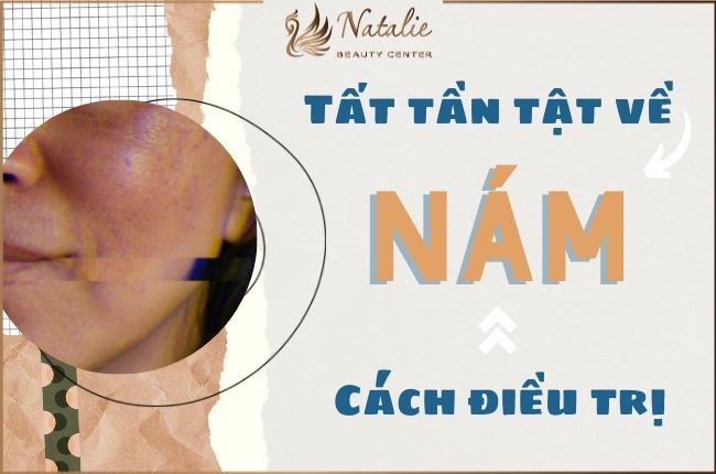 nam-da-va-cach-dieu-tri