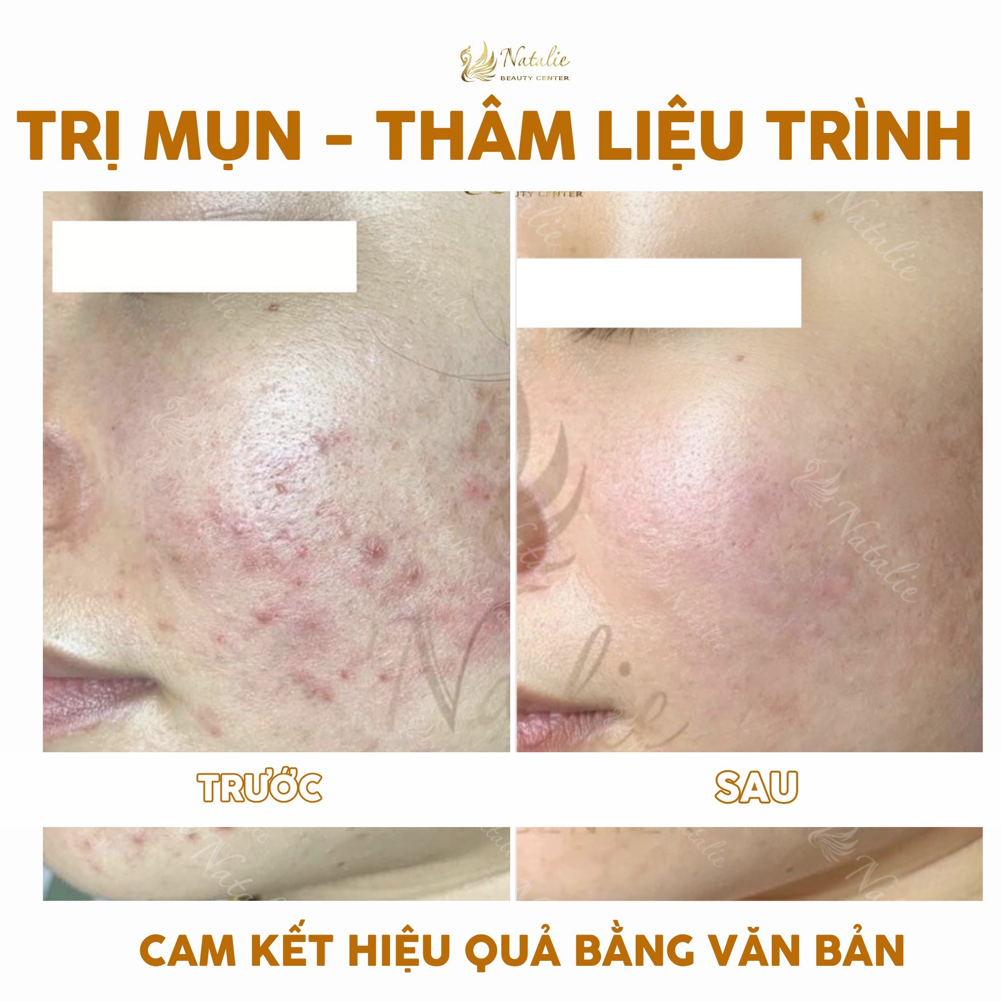 peel tri mun ba