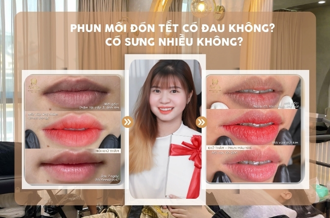 phun môi có đau sưng không