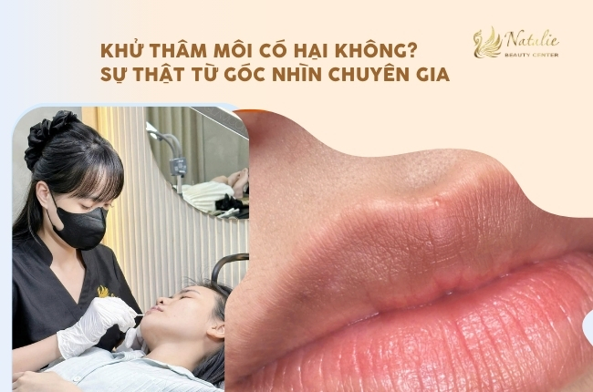 khử thâm hại hay không