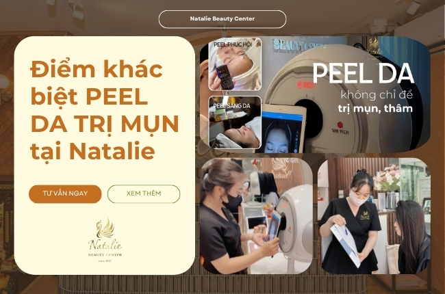 Điểm khác trị mụn tại na