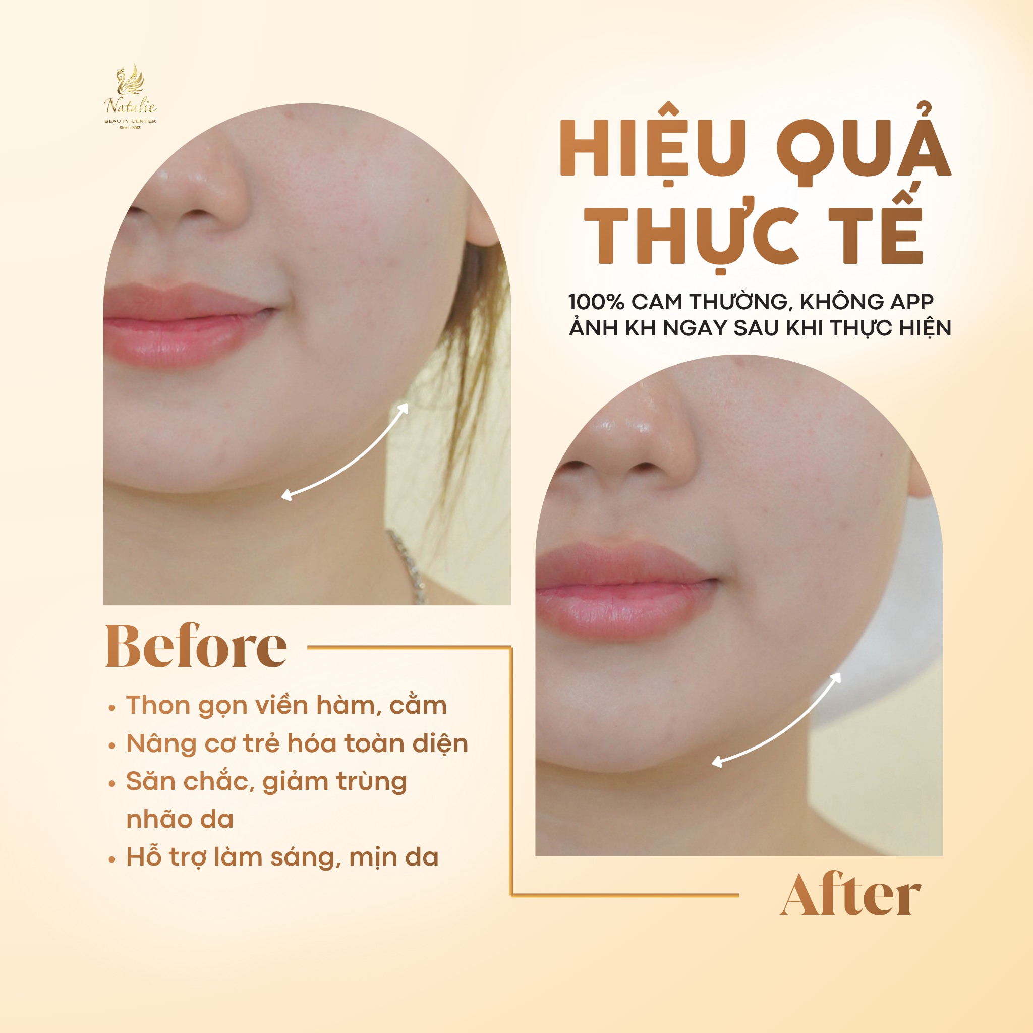 hiệu quả thực tế hifu