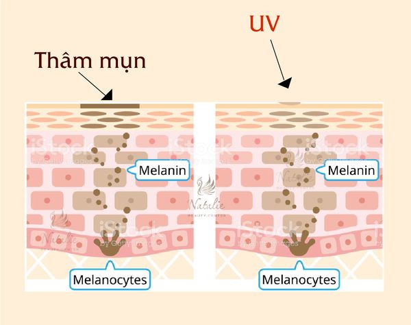 vet-tham-mun