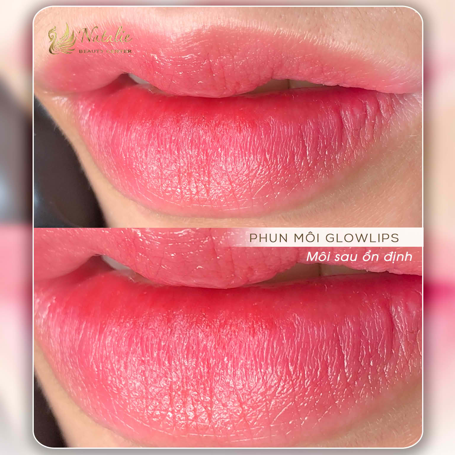 Phun môi phun mày phun mí đẹp không sưng