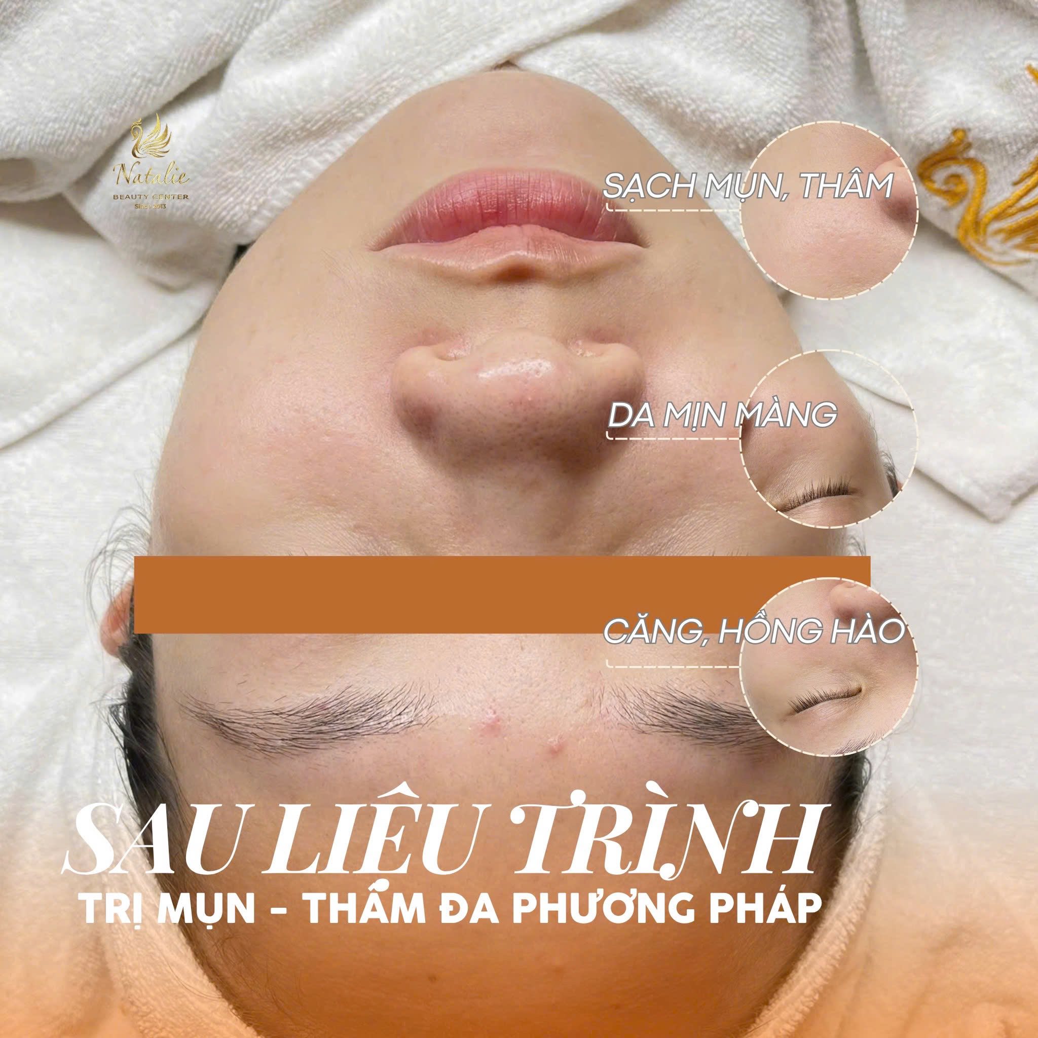 Phun môi phun mày phun mí đẹp không sưng