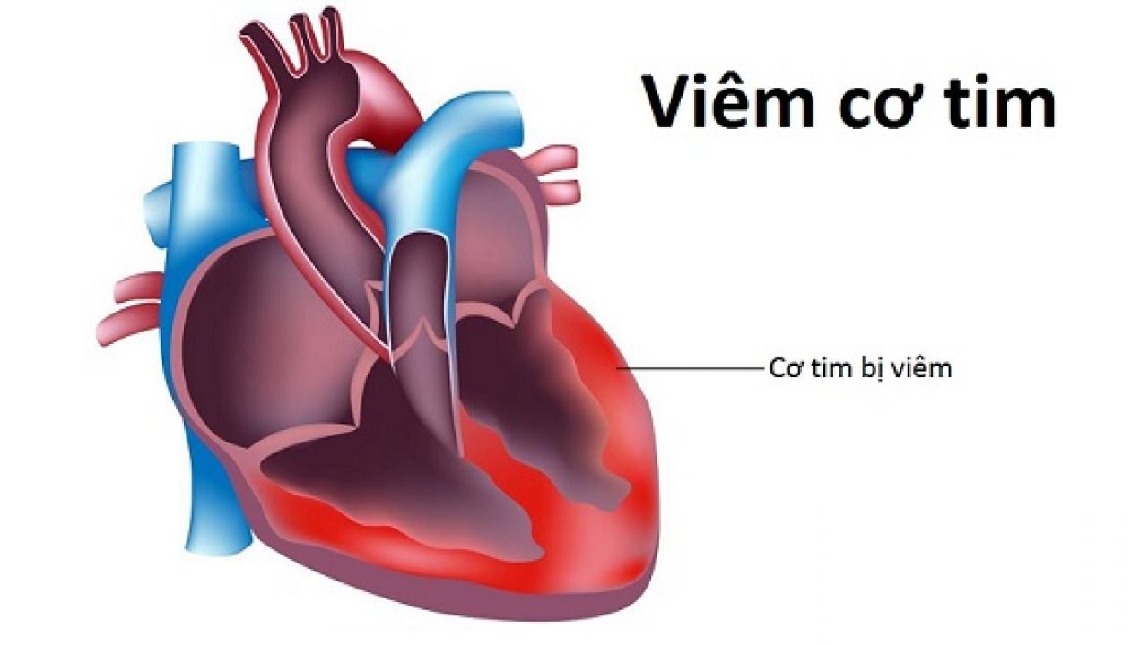 viem-co-tim