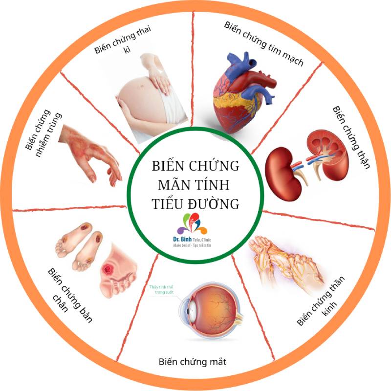 Các biến chứng nguy hiểm của bệnh tiểu đường type 1 và Type 2