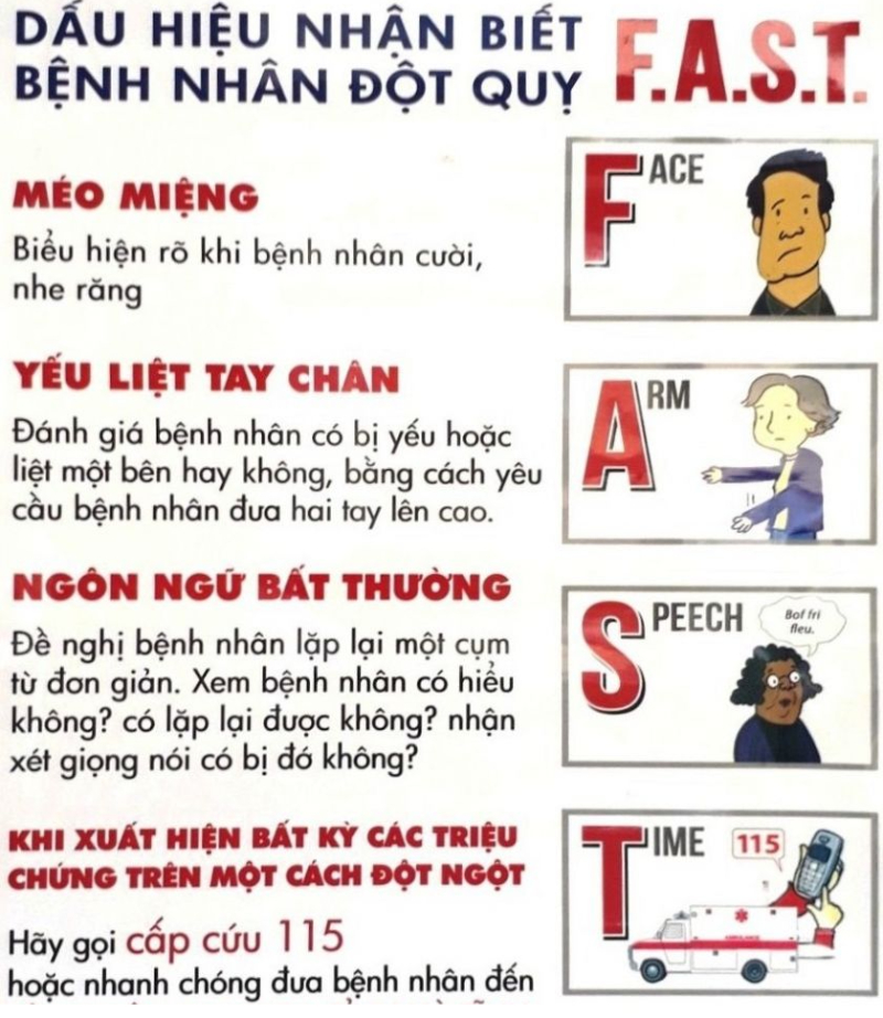 Quy tắc F.A.S.T phát hiện dấu hiệu báo trước của tai biến mạch máu não (đột quỵ não)