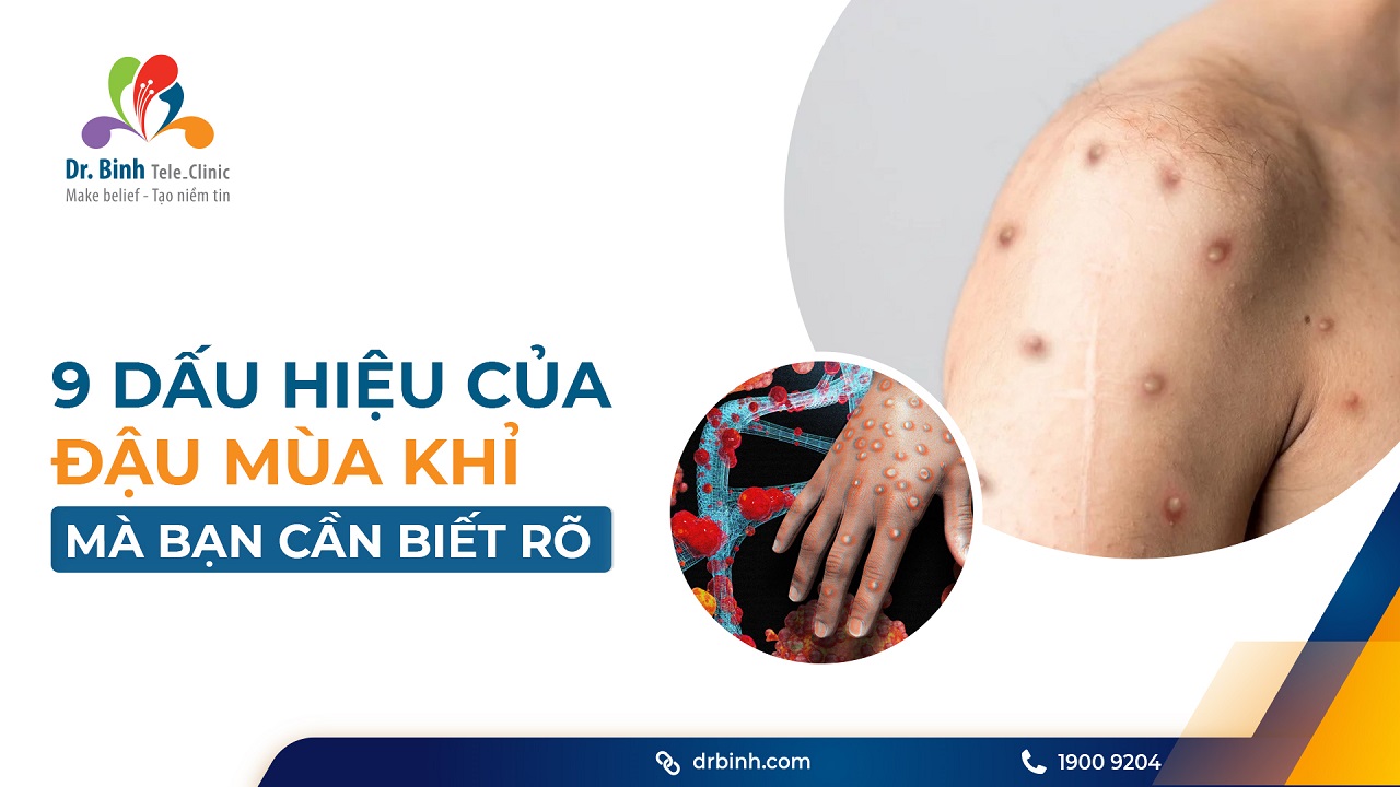 Dấu hiệu nhận biết của đậu mùa khỉ