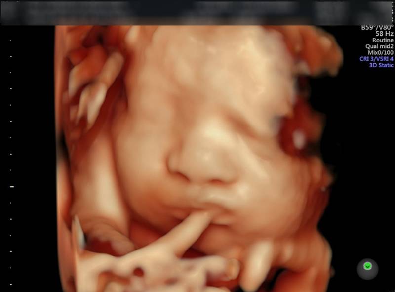 Hình ảnh siêu âm 4D thai nhi đang ngậm ngón tay trong bụng mẹ