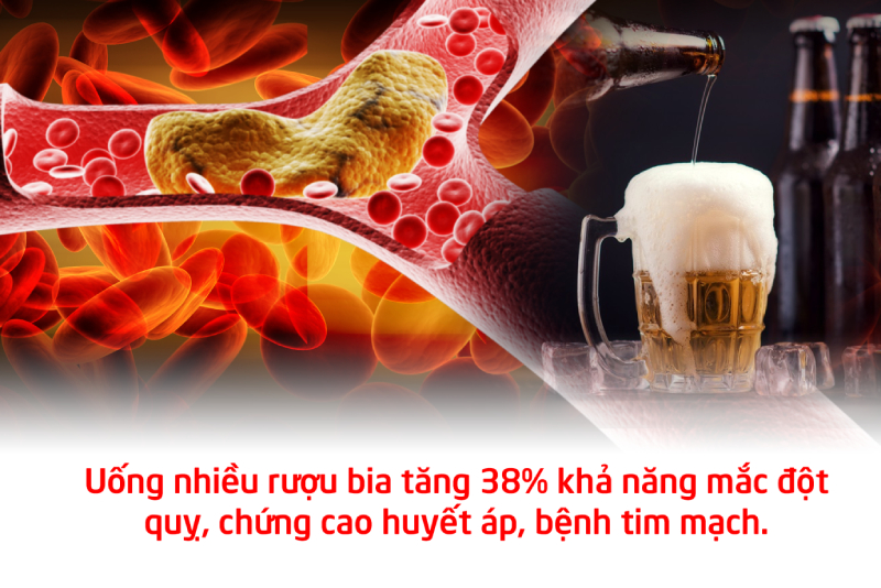 Lạm dụng rượu bia và các chất kích thích là nguyên nhân chính dẫn tới tình trạng tai biến mạch máu não ở người trẻ tuổi