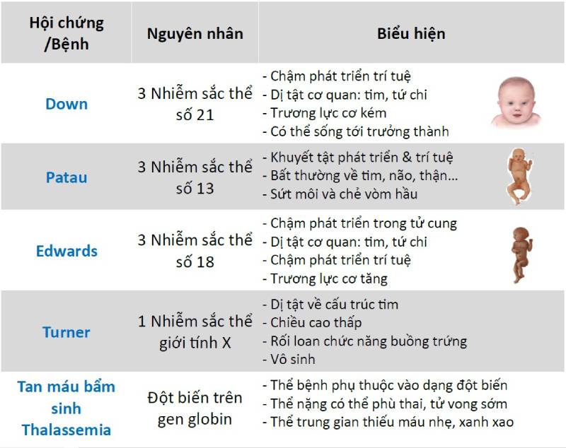 Xét nghiệm sàng lọc trước sinh NIPT có thể phát hiện hầu hết các dị tật bẩm sinh thông qua ADN tự do
