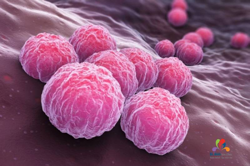 Xác định con đường lây nhiễm của vi khuẩn Chlamydia là gì?