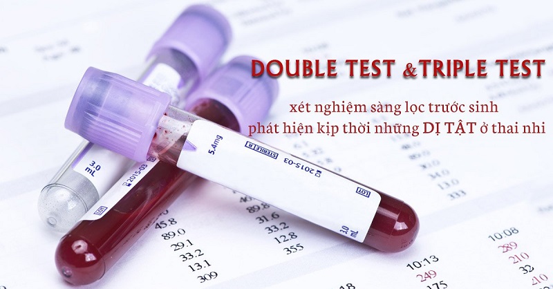 Làm xét nghiệm sàng lcoj trước sinh trong 3 tháng đầu thai kì