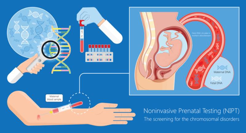 Review top 4 Các loại xét nghiệm nipt trước sinh cho thai phụ