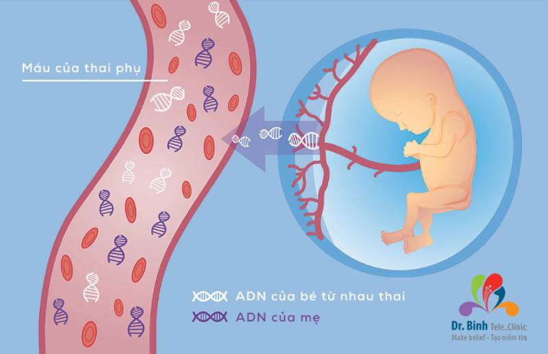 Phương pháp xét nghiệm NIPT không xấm lấn có thể phát hiện bệnh Down chính xác thường được chỉ định sau khi siêu âm thai 4D