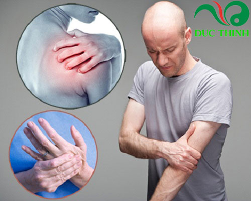 Cây bìm bịp hỗ trợ trị thoái hóa cột sống