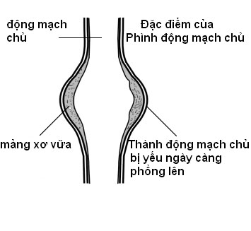 bệnh của động mạch  cảnh