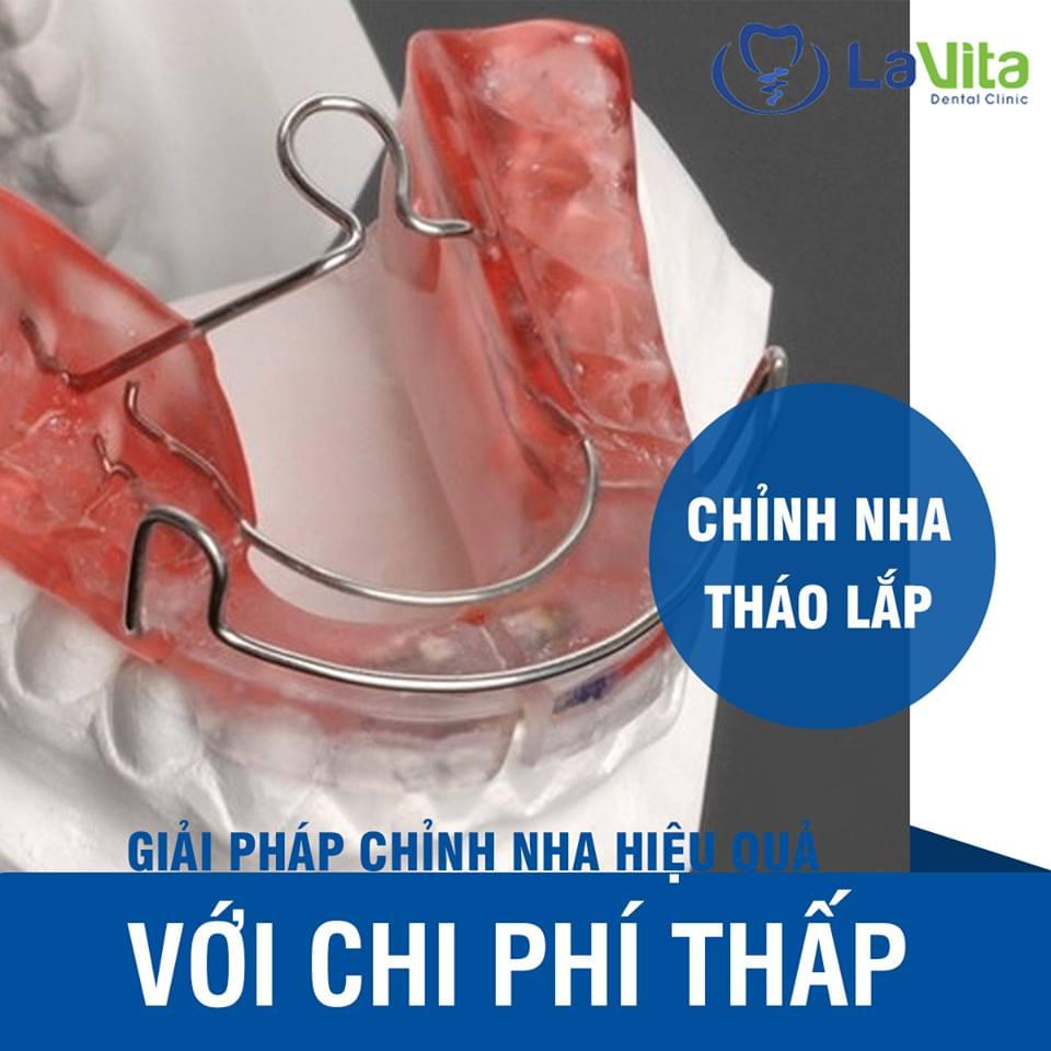 Hàm tháo lắp
