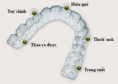 Niềng răng Invisalign
