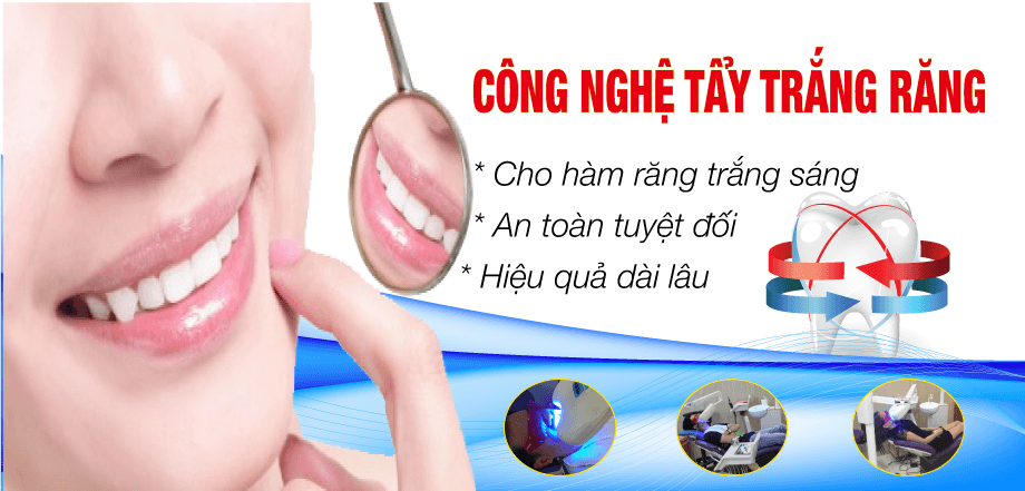 Tẩy trắng răng