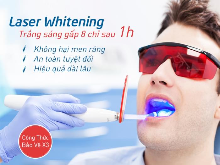 Tẩy trắng răngq