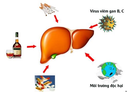 Những thực phẩm nào người bị bệnh viêm gan nên dùng?