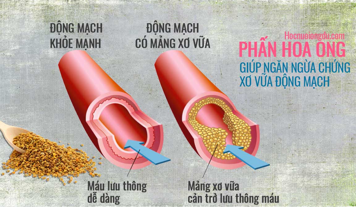 Chống xơ vữa mạch máu khi sử dụng phấn hoa