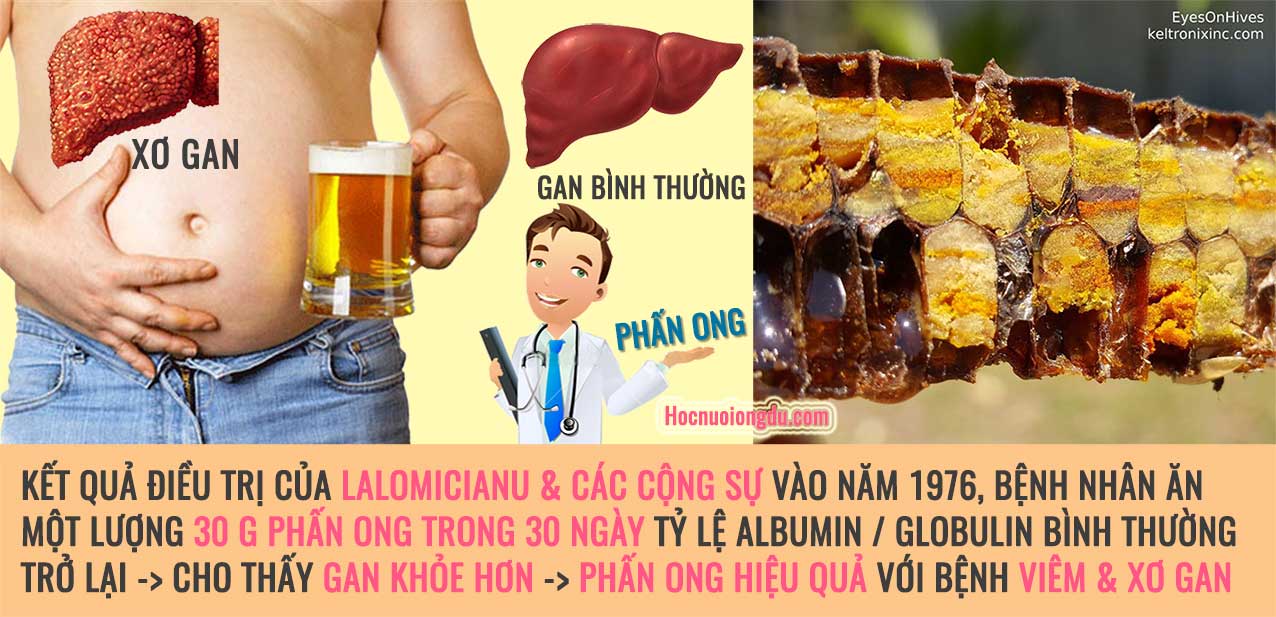 Phấn ong chữa viêm gan và điều trị xơ gan tốt nhất