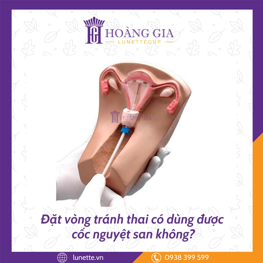 Đặt vòng tránh thai có dùng được cốc nguyệt san không?