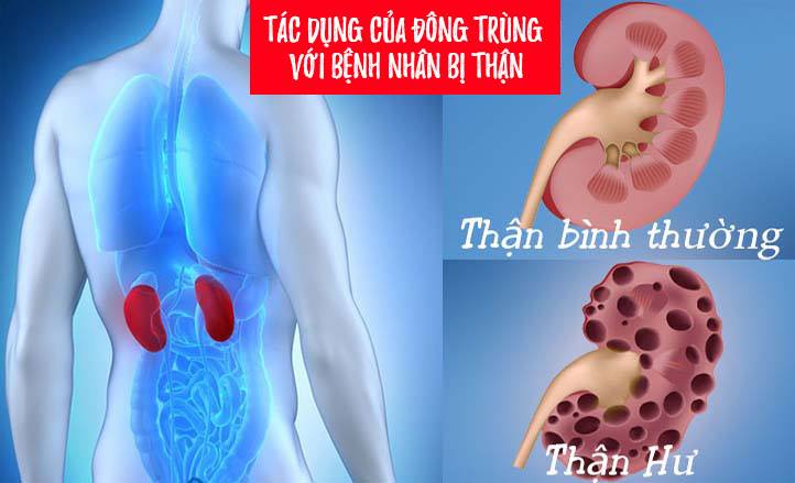 Tác dụng của đông trùng hạ thảo với bệnh nhân thận mãn tính