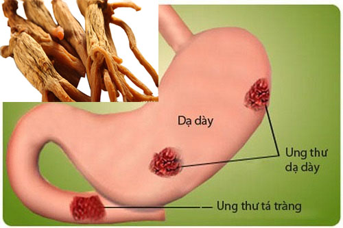 Những món ăn tốt cho người bệnh đau dạ dày