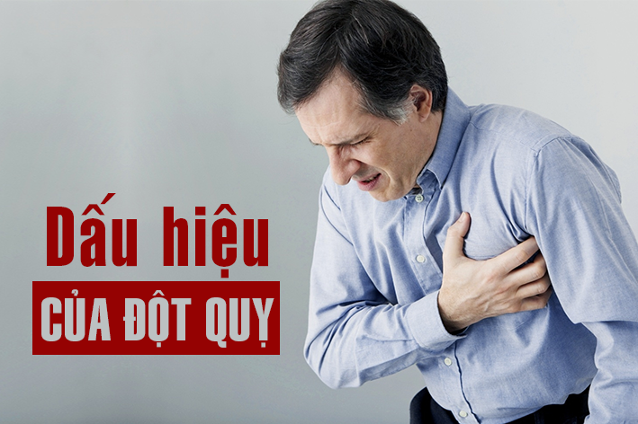 Dấu hiệu của đột quỵ