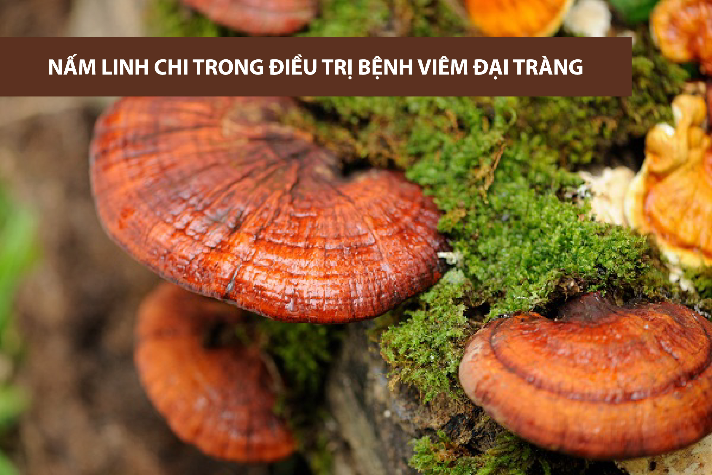 Tác dụng của nấm linh chi với bệnh viêm đại tràng