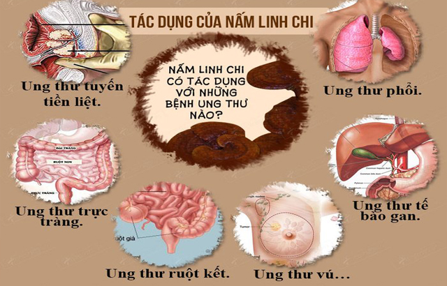 Hiệu quả của nấm linh chi trong phòng chống bệnh ung thư