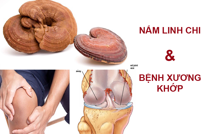 Tác dụng của nấm linh chi với bệnh xương khớp