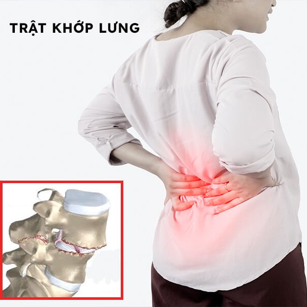 dieu-tri-trat-khop-lien-mau-dot-song-lung-bang-y-hoc-co-truyen