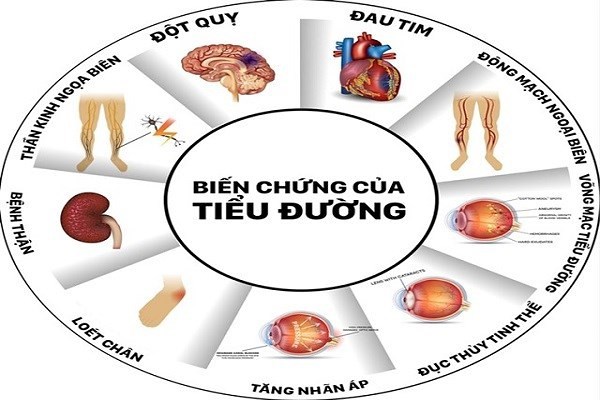 Izumio và Super Lutein phòng và hỗ trợ biến chứng tiểu đường