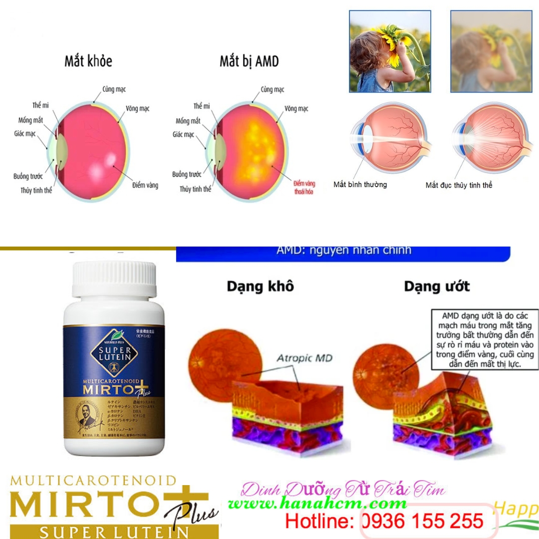 Lutein 1 trong 13 thành phần của Super Lutien Mirto Plus có tác dụng gì ?
